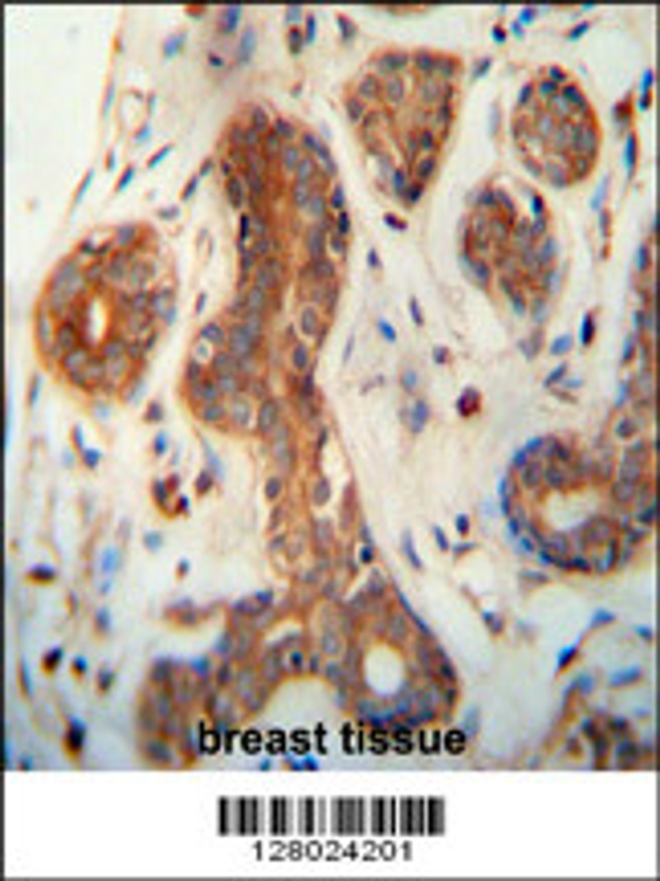 CEPT1 antibody immunohistochemistry analysis in formalin fixed and paraffin embedded human breast tissue followed by peroxidase conjugation of the secondary antibody and DAB staining.