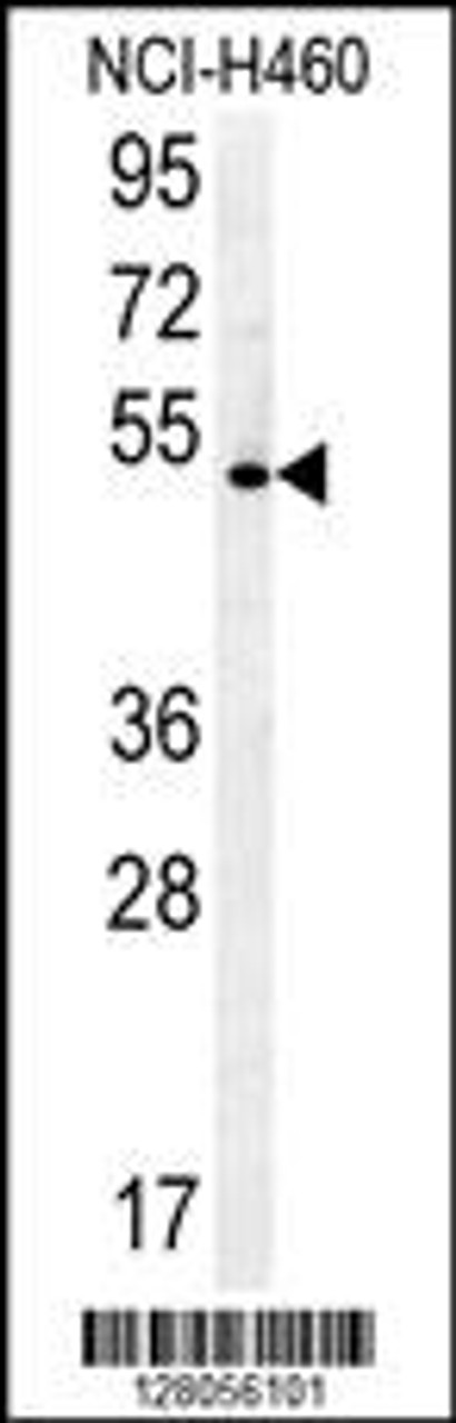 Western blot analysis in NCI-H460 cell line lysates (35ug/lane) .