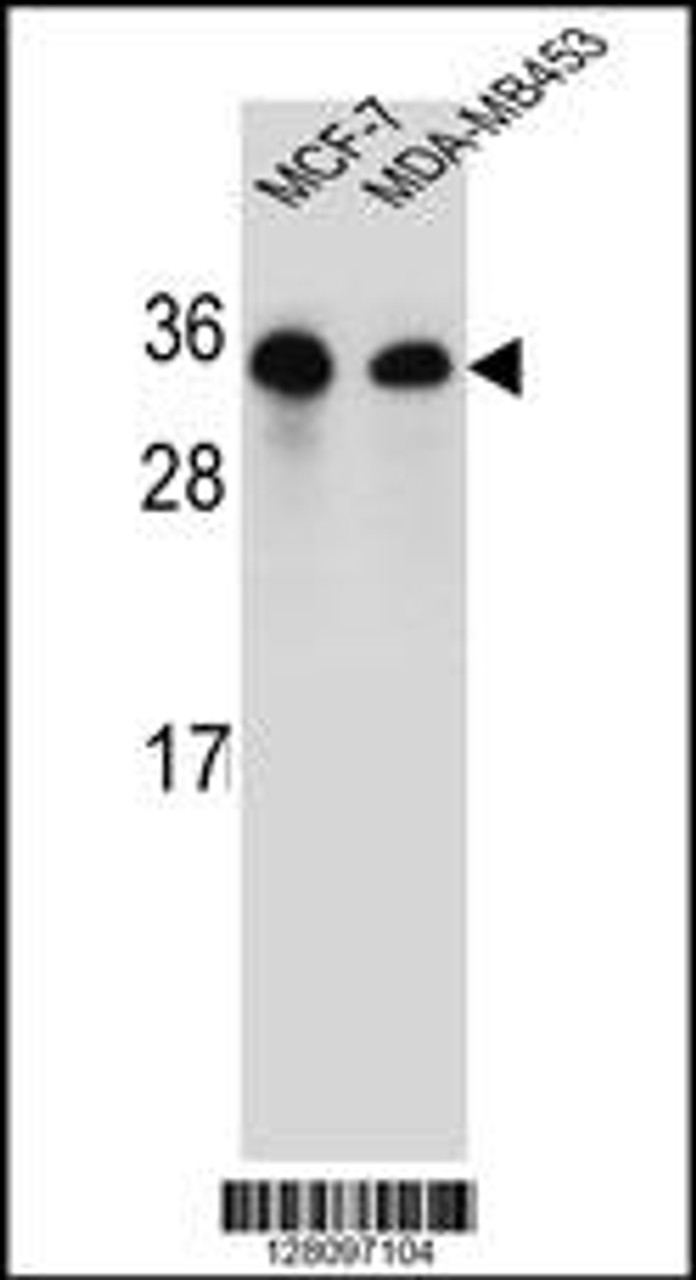 Western blot analysis in MCF-7, MDA-MB453 cell line lysates (35ug/lane) .