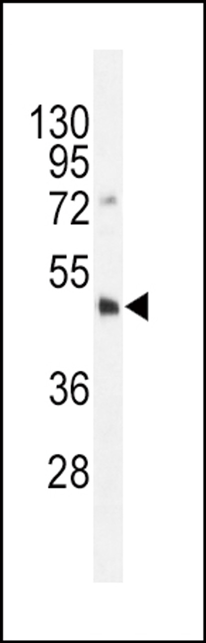 Western blot analysis in HL-60 cell line lysates (35ug/lane) .This demonstrates the DNMT3L antibody detected the DNMT3L protein (arrow) .