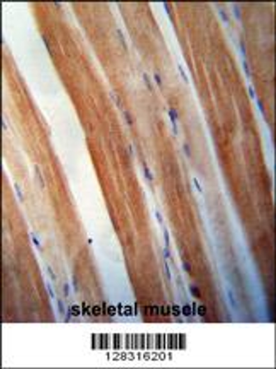 KBTBD5 antibody immunohistochemistry analysis in formalin fixed and paraffin embedded human skeletal muscle followed by peroxidase conjugation of the secondary antibody and DAB staining.