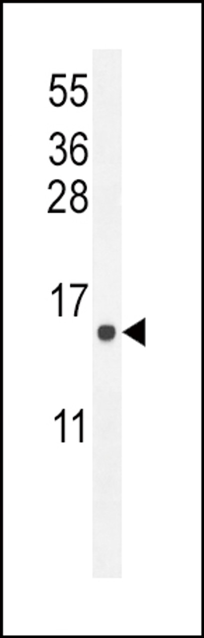 Western blot analysis in U251 cell line lysates (35ug/lane) .This demonstrates tdetected the EKI2 protein (arrow) .