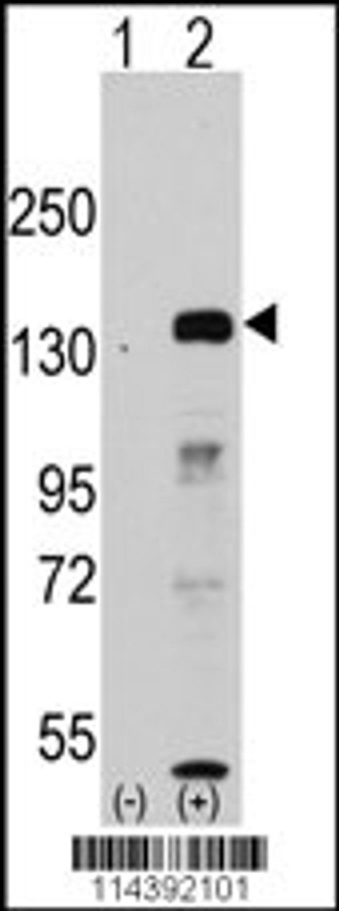 Western blot analysis of JHDM1a/FBXL11 using rabbit polyclonal JHDM1a/FBXL11 Antibody.293 cell lysates (2 ug/lane) either nontransfected (Lane 1) or transiently transfected with the JHDM1a/FBXL11 gene (Lane 2) .