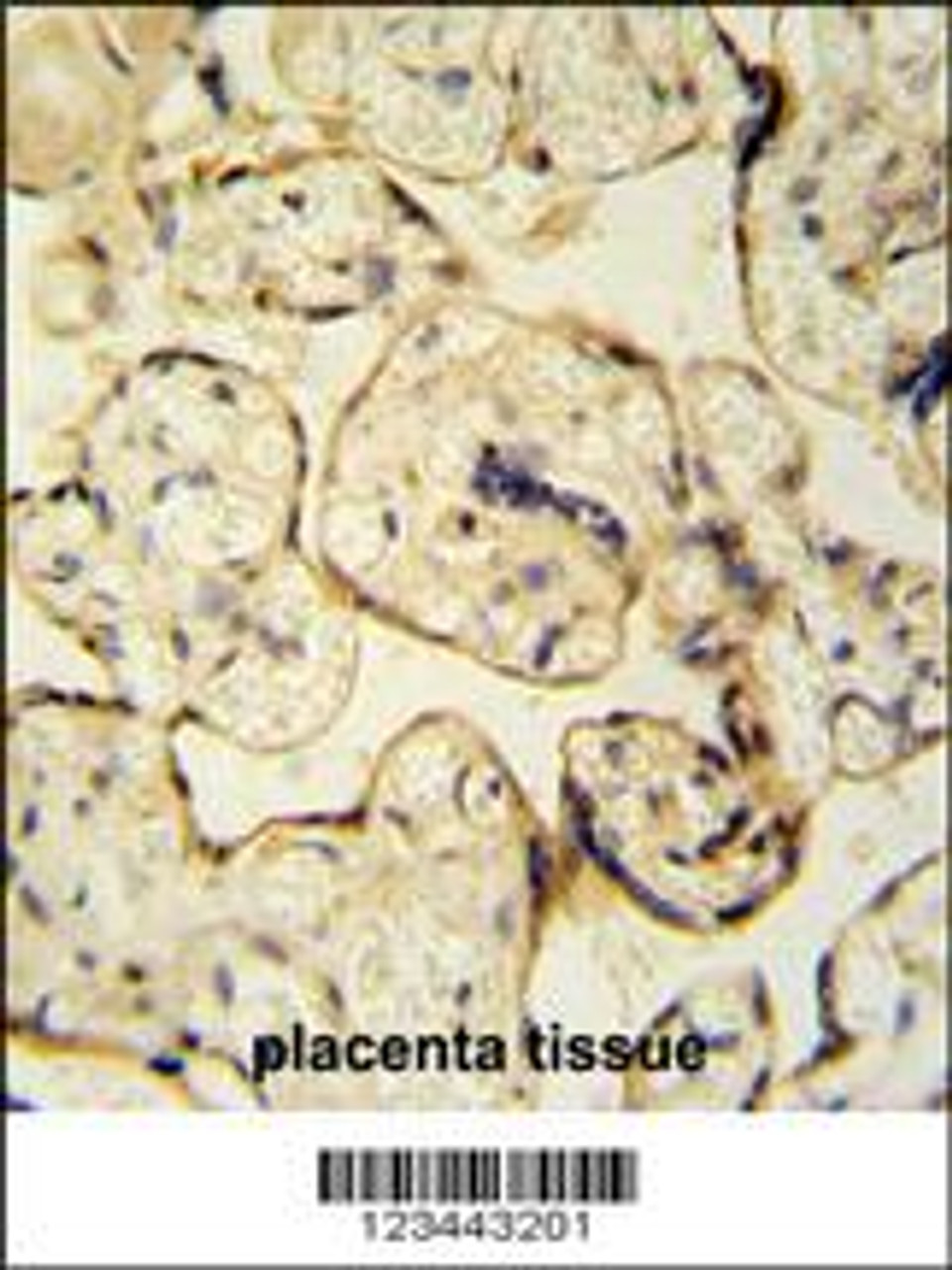 CLIC6 antibody immunohistochemistry analysis in formalin fixed and paraffin embedded human placenta tissue tissue followed by peroxidase conjugation of the secondary antibody and DAB staining.