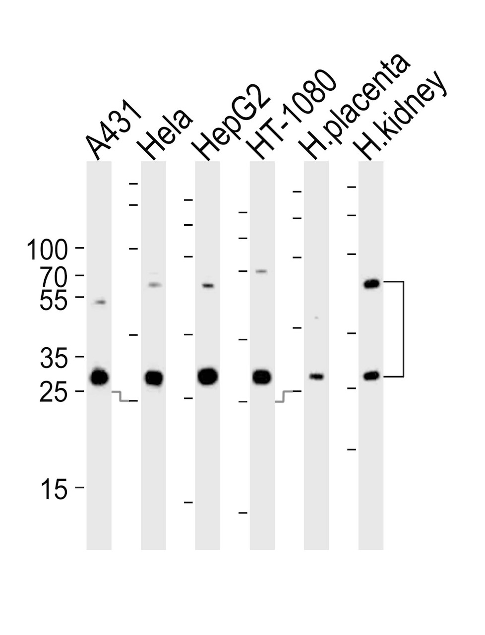 Western blot analysis of lysates from A431, Hela, HepG2, HT-1080 cell line and human placenta, kidney tissue lysate (from left to right) , using CTSA Antibody at 1:1000 at each lane.