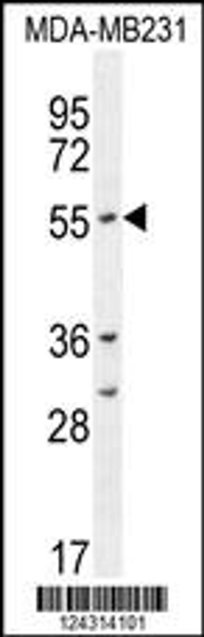 Western blot analysis in MDA-MB231 cell line lysates (35ug/lane) .