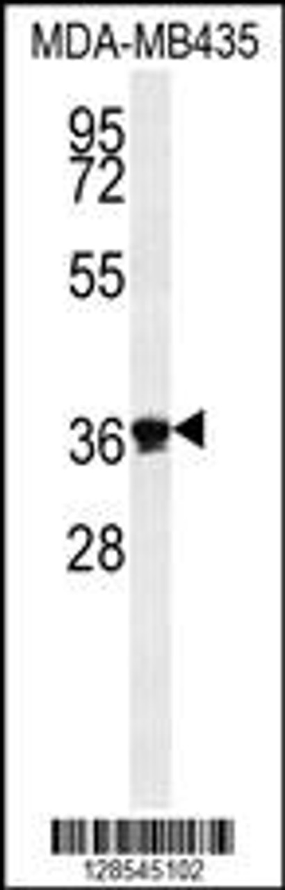 Western blot analysis in MDA-MB435 cell line lysates (35ug/lane) .