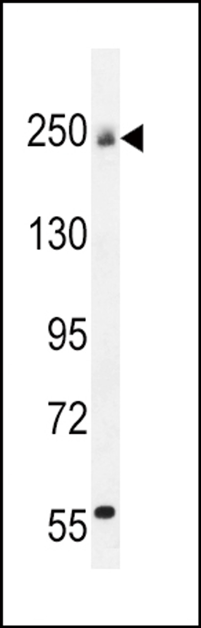 Western blot analysis in mouse bladder tissue lysates (35ug/lane) .