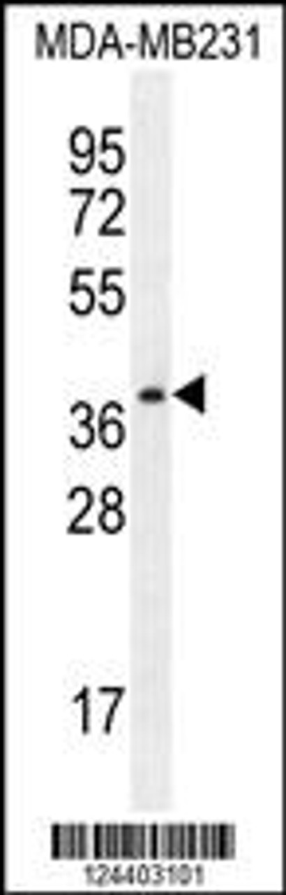 Western blot analysis in MDA-MB231 cell line lysates (35ug/lane) .