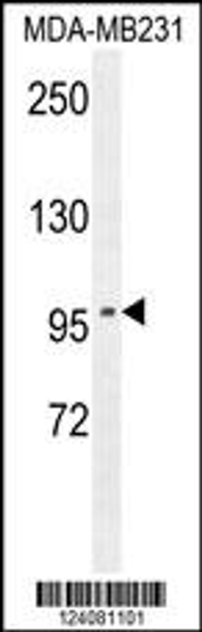 Western blot analysis in MDA-MB231 cell line lysates (35ug/lane) .