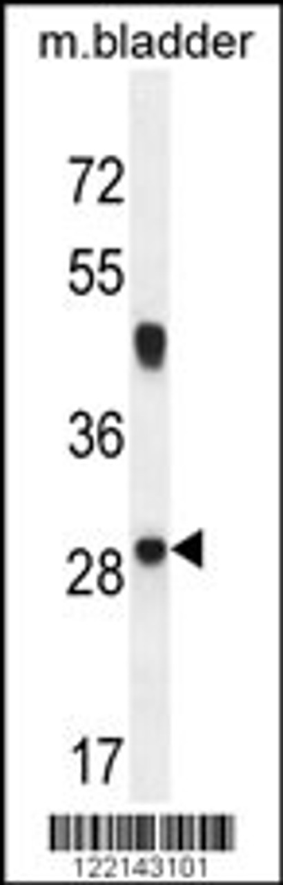 Western blot analysis in mouse bladder tissue lysates (35ug/lane) .