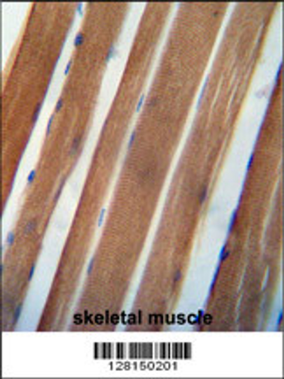NDUAB antibody immunohistochemistry analysis in formalin fixed and paraffin embedded human skeletal muscle followed by peroxidase conjugation of the secondary antibody and DAB staining.