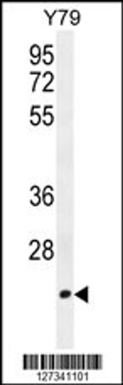 Western blot analysis in Y79 cell line lysates (35ug/lane) .