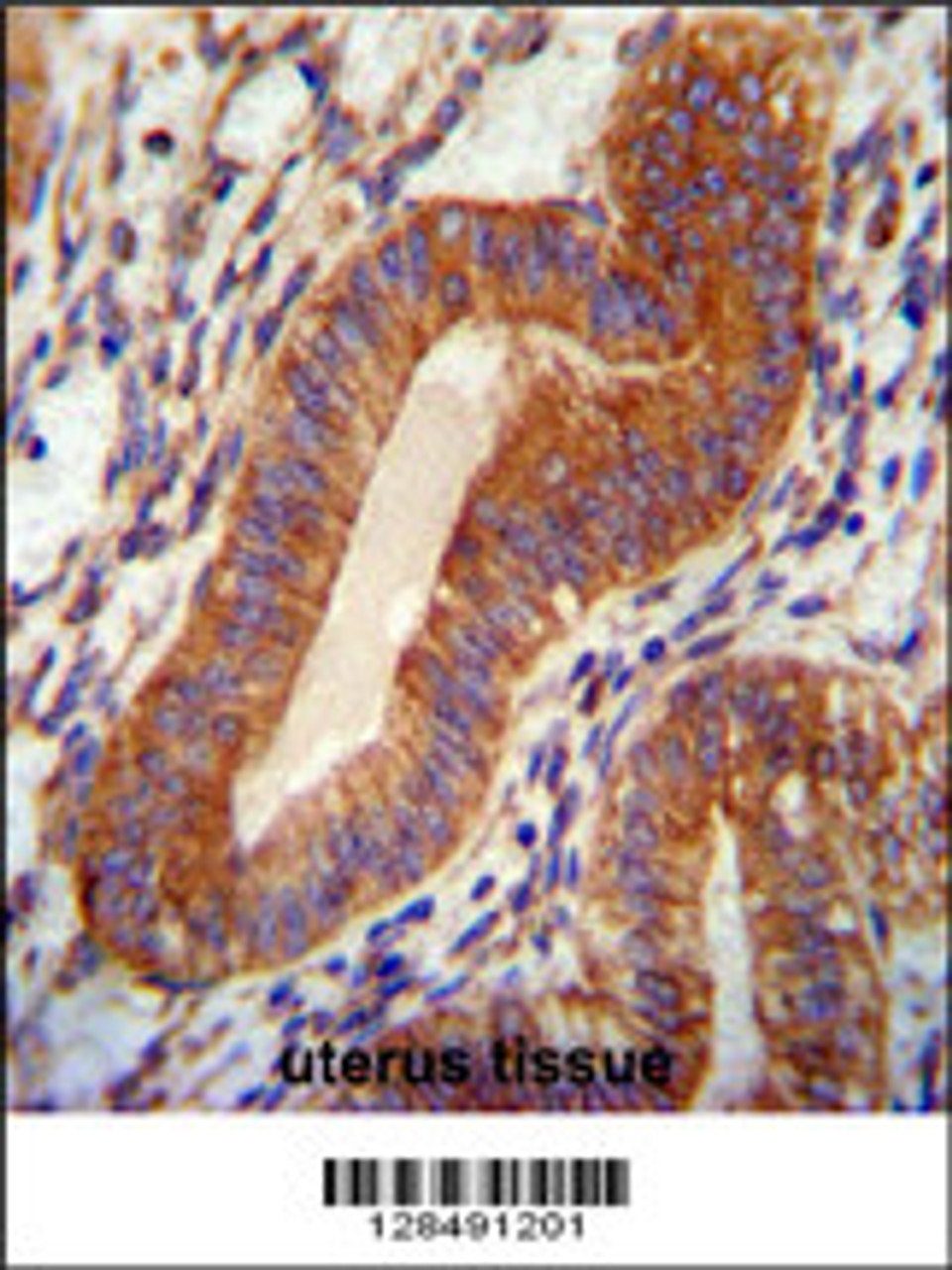 TPGS2 antibody immunohistochemistry analysis in formalin fixed and paraffin embedded human uterus tissue followed by peroxidase conjugation of the secondary antibody and DAB staining.