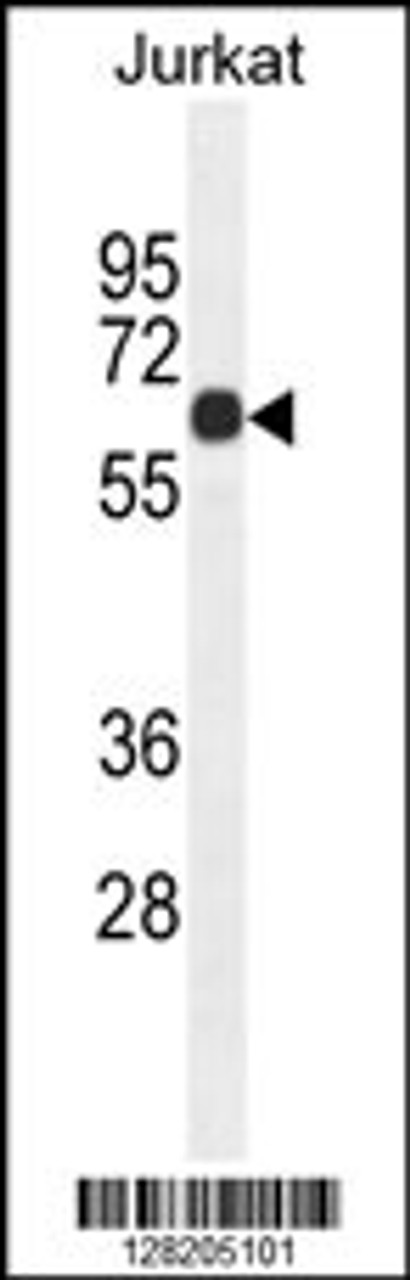 Western blot analysis in Jurkat cell line lysates (35ug/lane) .