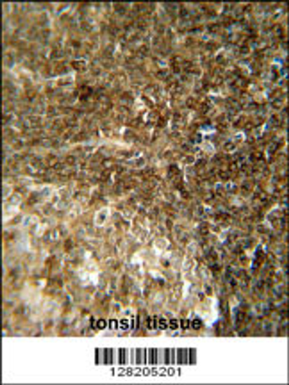 CCDC8 antibody immunohistochemistry analysis in formalin fixed and paraffin embedded human tonsil tissue followed by peroxidase conjugation of the secondary antibody and DAB staining.