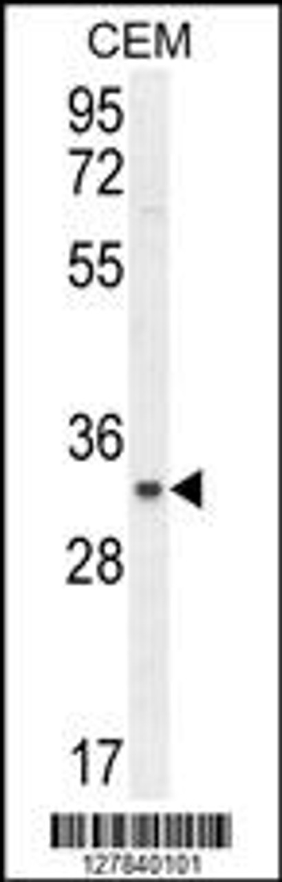 Western blot analysis in CEM cell line lysates (35ug/lane) .