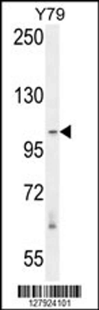 Western blot analysis in Y79 cell line lysates (35ug/lane) .