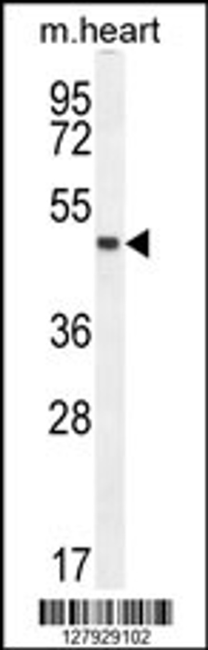 Western blot analysis in mouse heart tissue lysates (35ug/lane) .