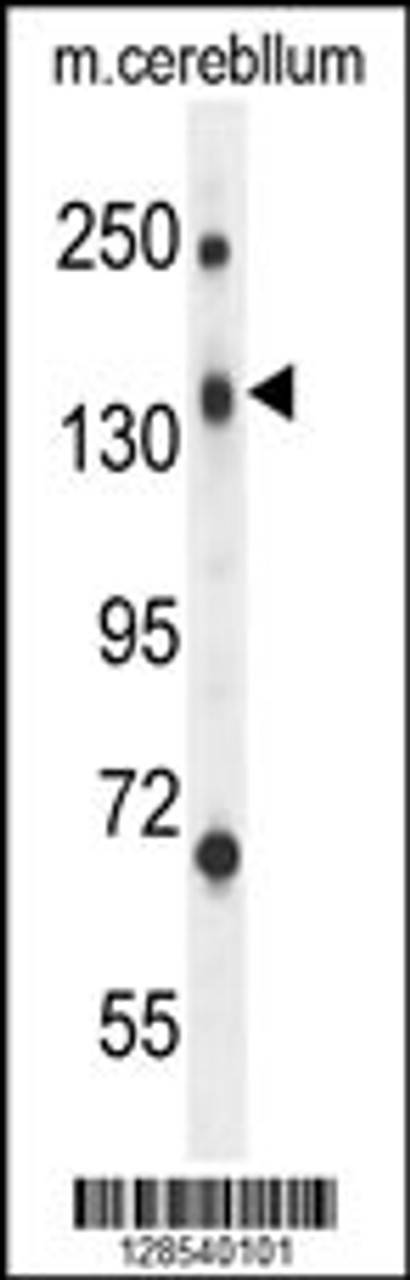 Western blot analysis in mouse cerebellum tissue lysates (35ug/lane) .