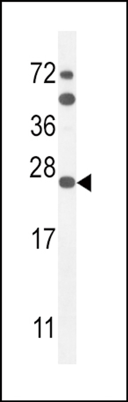 Western blot analysis in mouse Neuro-2a cell line lysates (35ug/lane) .