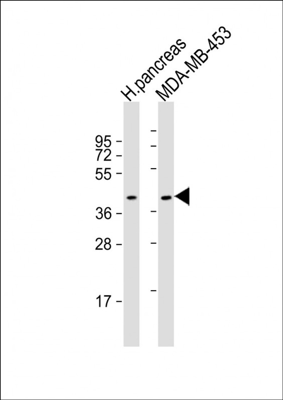 Western Blot at 1:2000 dilution Lane 1: human pancreas lysate Lane 2: MDA-MB-453 whole cell lysate Lysates/proteins at 20 ug per lane.