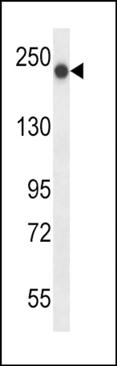 Western blot analysis in mouse bladder tissue lysates (35ug/lane) .