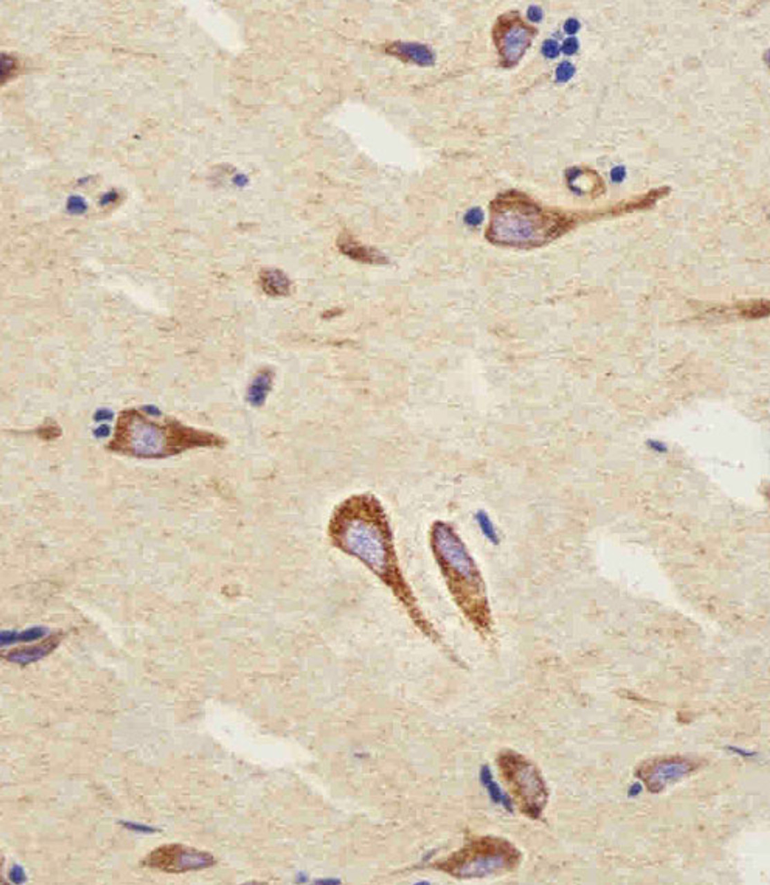 Immunohistochemical analysis of paraffin-embedded H. brain section using CB2 Antibody. Antibody was diluted at 1:25 dilution. A peroxidase-conjugated goat anti-rabbit IgG at 1:400 dilution was used as the secondary antibody, followed by DAB staining.