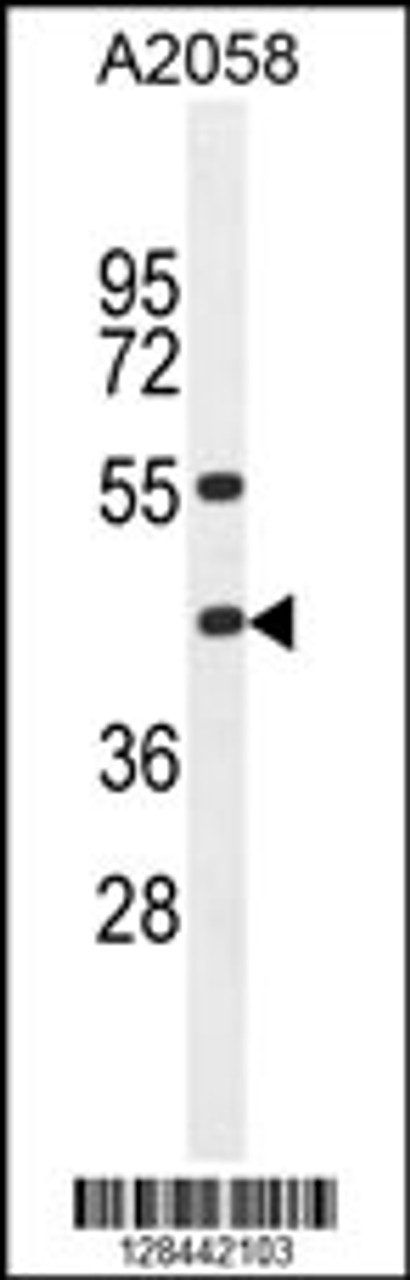 Western blot analysis in A2058 cell line lysates (35ug/lane) .