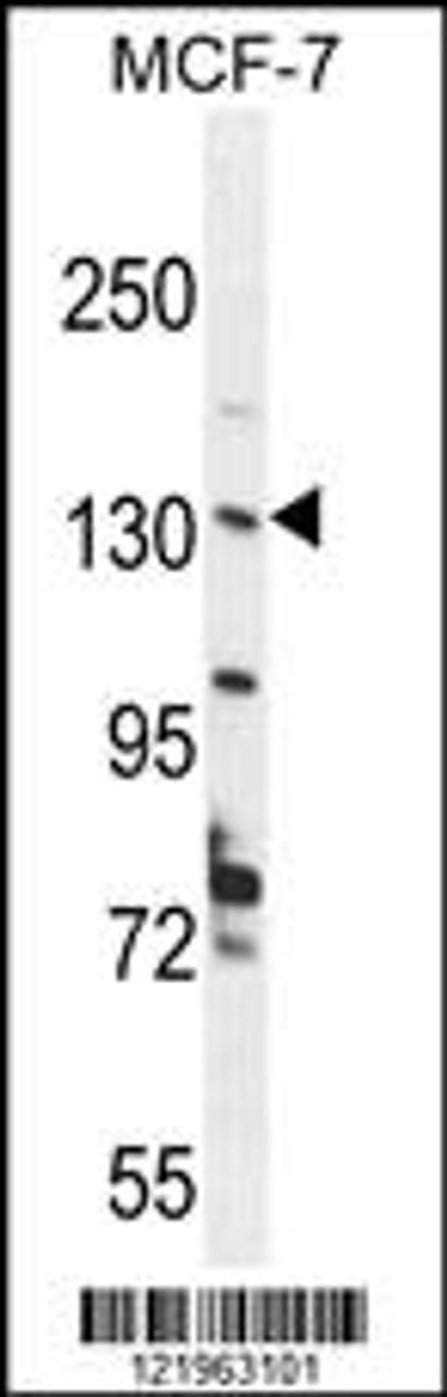 Western blot analysis in MCF-7 cell line lysates (35ug/lane) .
