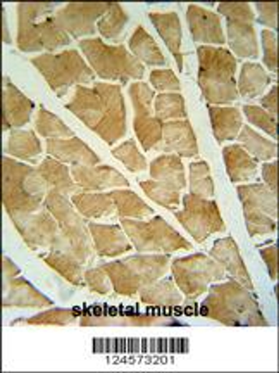 ARHGAP10 antibody immunohistochemistry analysis in formalin fixed and paraffin embedded human skeletal muscle followed by peroxidase conjugation of the secondary antibody and DAB staining.