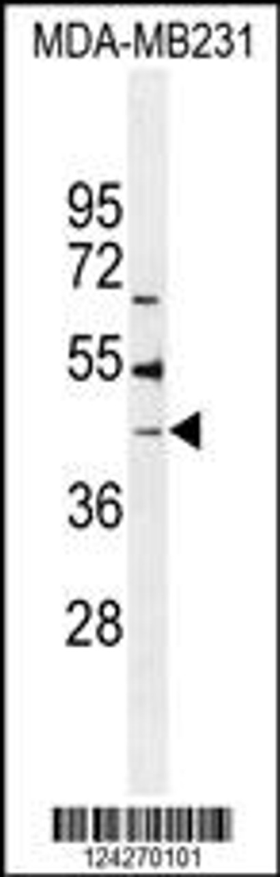 Western blot analysis in MDA-MB231 cell line lysates (35ug/lane) .