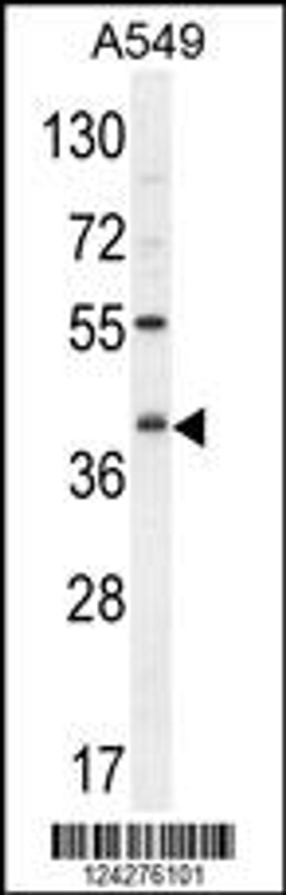 Western blot analysis in A549 cell line lysates (35ug/lane) .