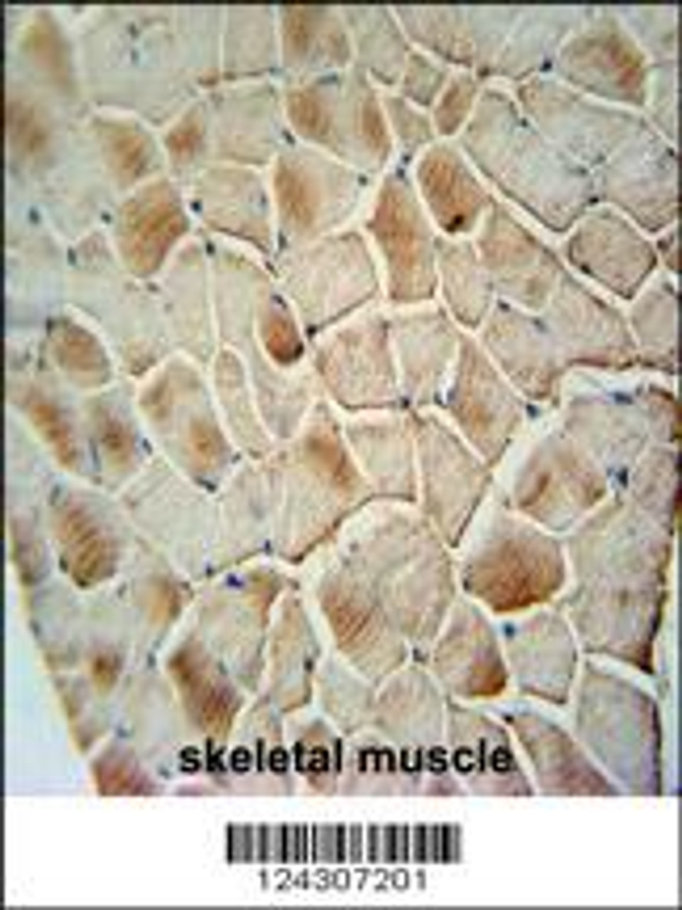 COX10 antibody immunohistochemistry analysis in formalin fixed and paraffin embedded human skeletal muscle followed by peroxidase conjugation of the secondary antibody and DAB staining.