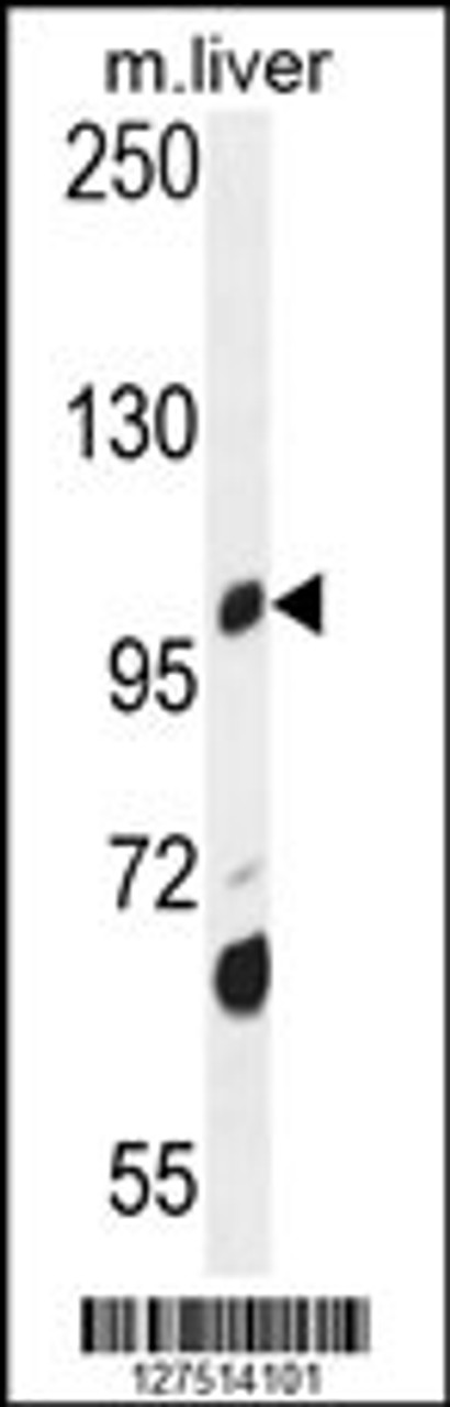 Western blot analysis in mouse liver tissue lysates (35ug/lane) .