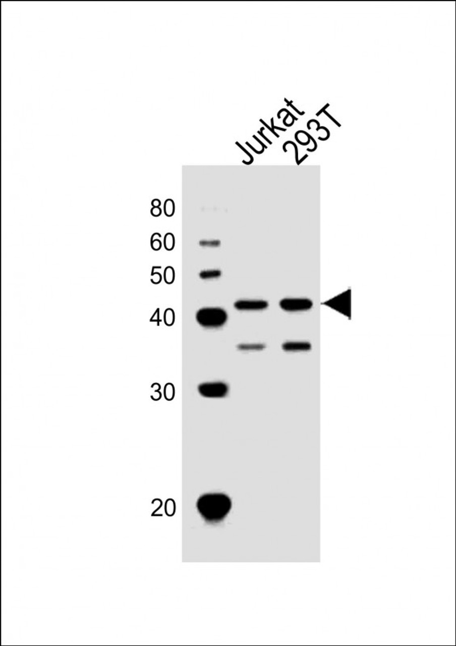 Western Blot at 1:1000 dilution Lane 1: Jurkat whole cell lysates Lane 2: 293T whole cell lysates Lysates/proteins at 20 ug per lane.
