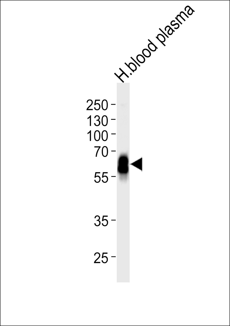 Western blot analysis of lysate from human blood plasma tissue lysate, using SERPINA6 Antibody at 1:1000 at each lane.