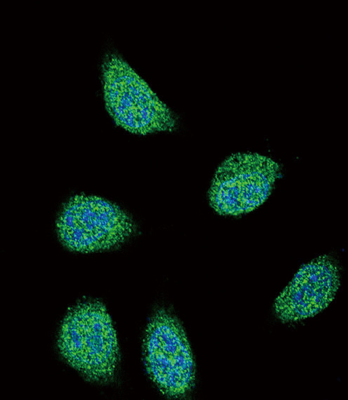 Confocal immunofluorescent analysis of SERPINA6 Antibody with 293 cell followed by Alexa Fluor 488-conjugated goat anti-rabbit lgG (green) . DAPI was used to stain the cell nuclear (blue) .