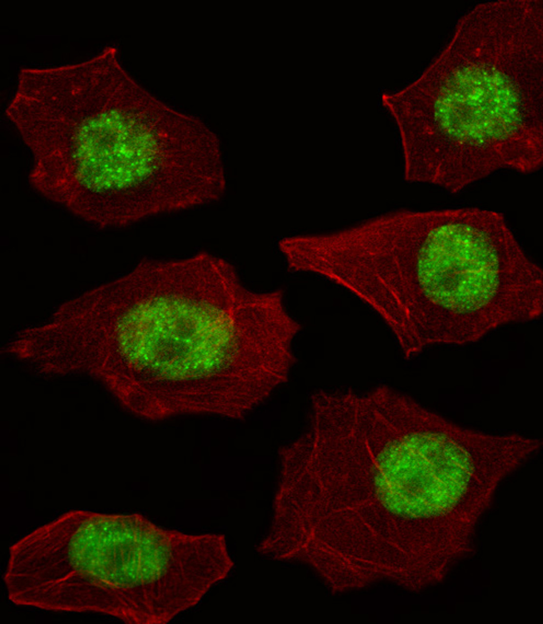 Fluorescent image of A549 cell stained with LMO4 Antibody .A549 cells were fixed with 4% PFA (20 min) , permeabilized with Triton X-100 (0.1%, 10 min) , then incubated with LMO4 primary antibody (1:25) . For secondary antibody, Alexa Fluor 488 conjugated donkey anti-rabbit antibody (green) was used (1:400) .Cytoplasmic actin was counterstained with Alexa Fluor 555 (red) conjugated Phalloidin (7units/ml) .LMO4 immunoreactivity is localized to Nucleus significantly.