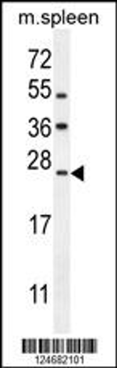 Western blot analysis in mouse spleen tissue lysates (35ug/lane) .