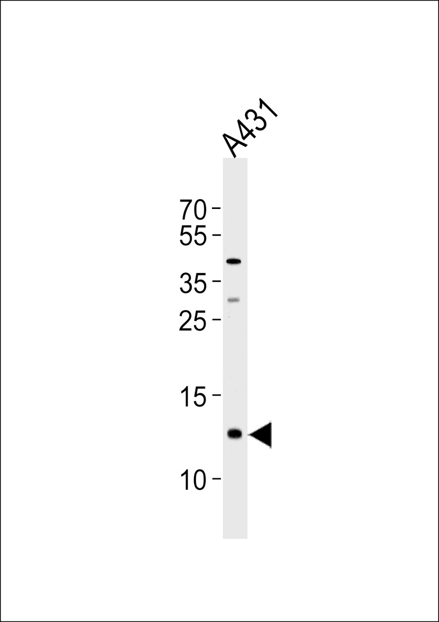 Western blot analysis of lysate from A431 cell line, using SPRR2A Antibody at 1:1000 at each lane.