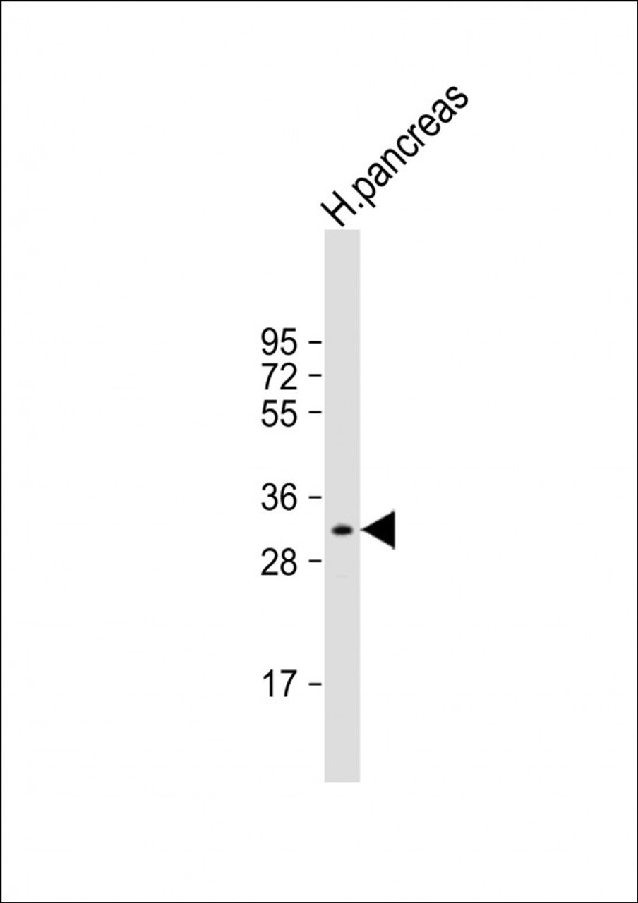 Western Blot at 1:1000 dilution + human pancreas lysate Lysates/proteins at 20 ug per lane.