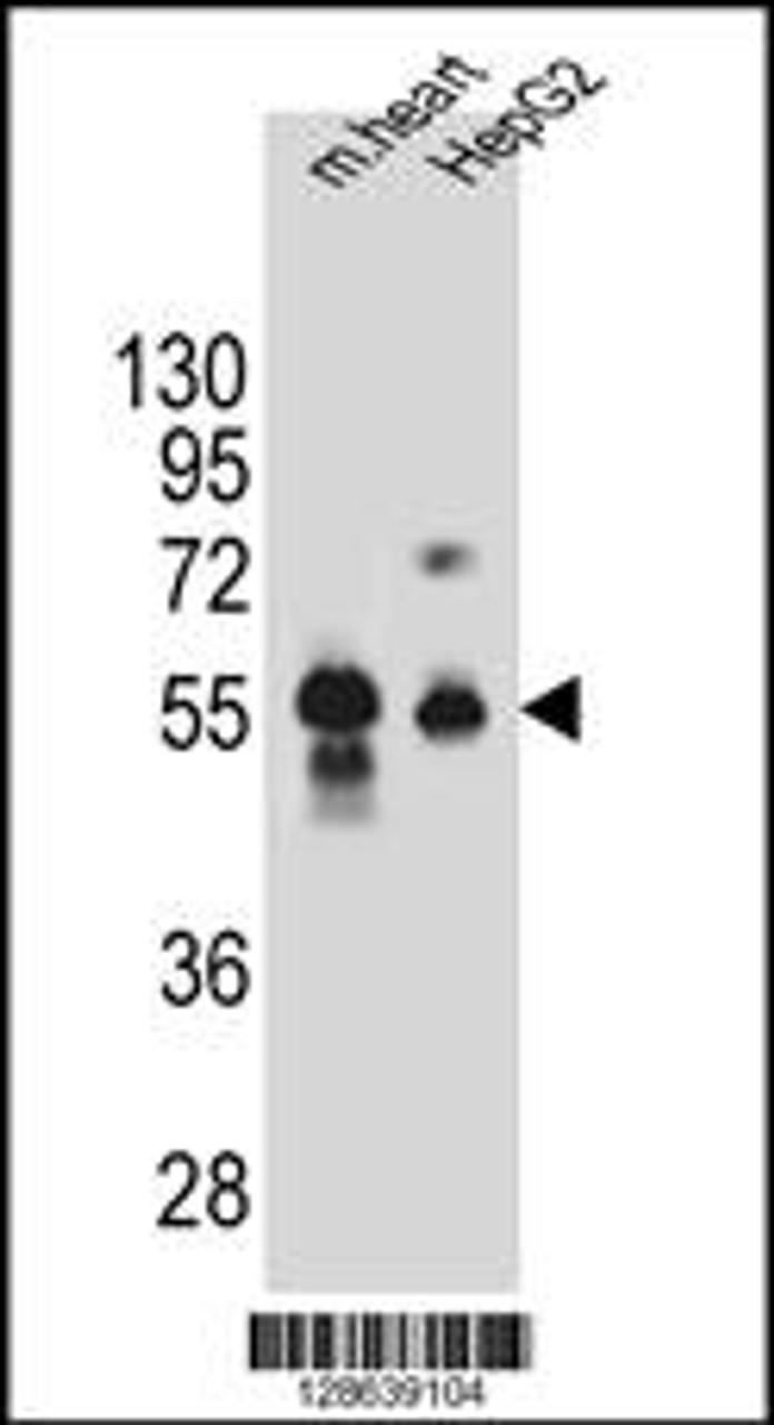Western blot analysis in mouse heart tissue and HepG2 cell line lysates (35ug/lane) .