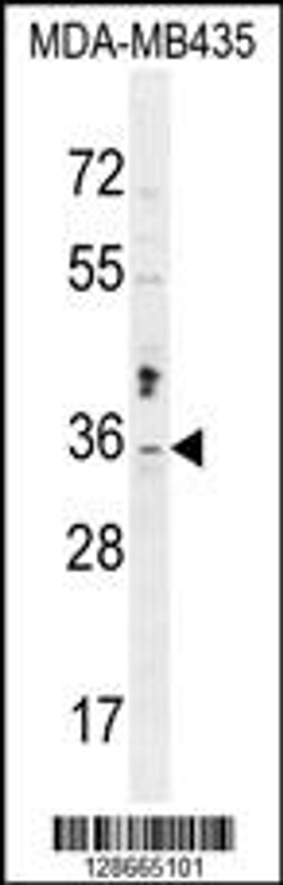 Western blot analysis in MDA-MB435 cell line lysates (35ug/lane) .