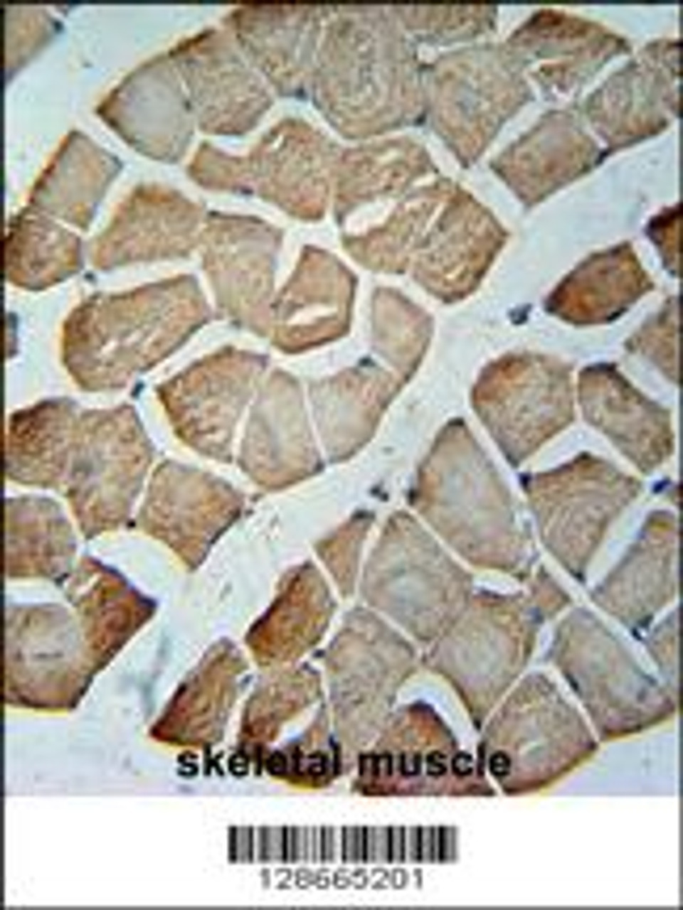 MTX2 Antibody immunohistochemistry analysis in formalin fixed and paraffin embedded human skeletal muscle followed by peroxidase conjugation of the secondary antibody and DAB staining.