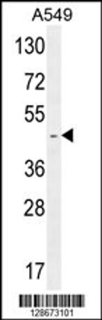 Western blot analysis in A549 cell line lysates (35ug/lane) .This demonstrates the Cat.detected the RBMX2 protein (arrow) .