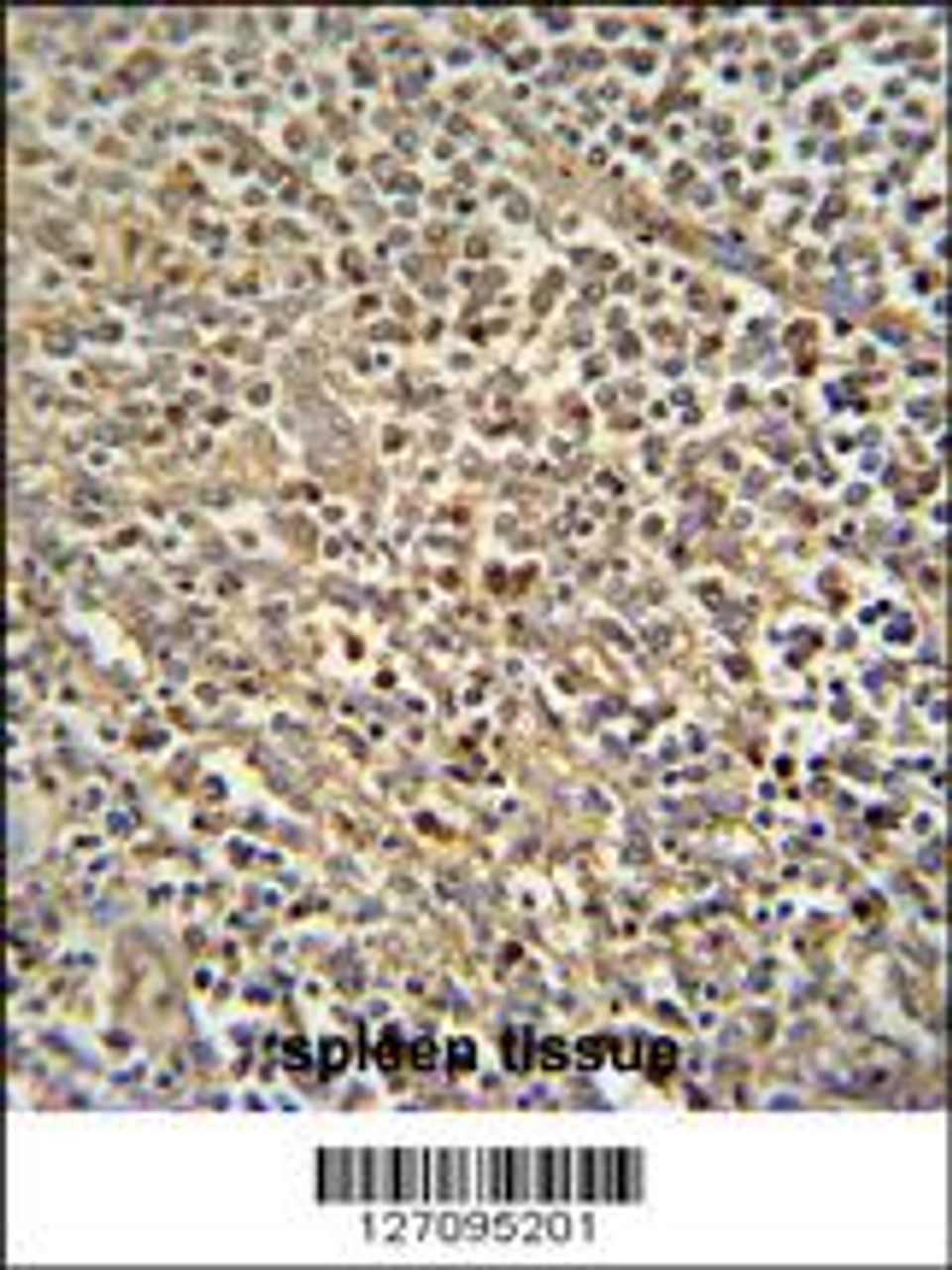 ZN180 antibody immunohistochemistry analysis in formalin fixed and paraffin embedded human spleen tissue followed by peroxidase conjugation of the secondary antibody and DAB staining.
