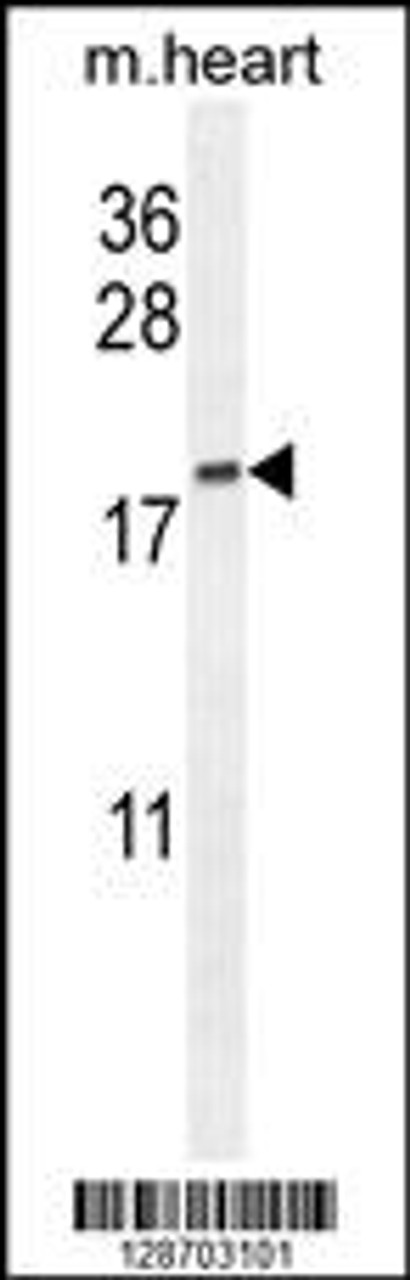 Western blot analysis in mouse heart tissue lysates (35ug/lane) .