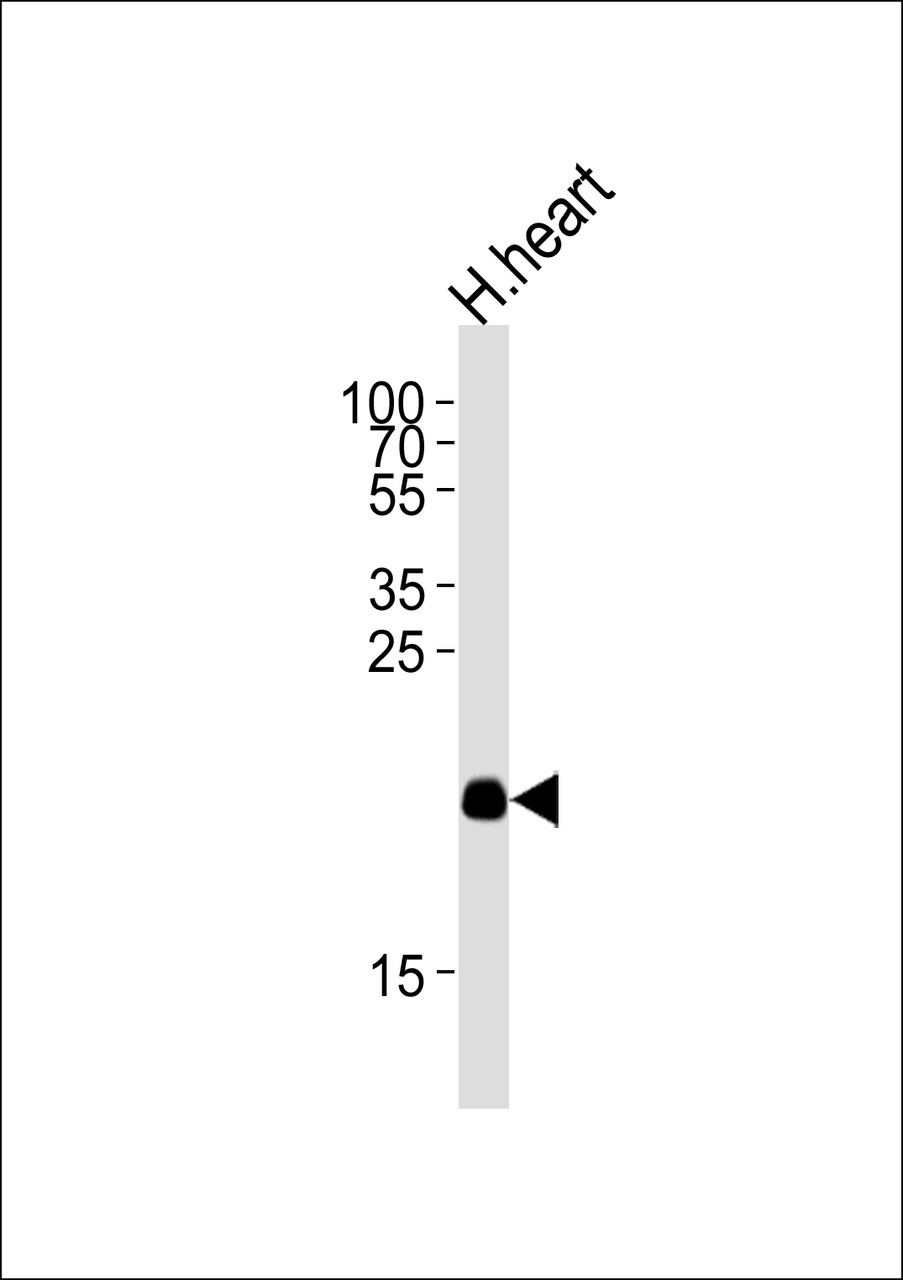 Western blot analysis of lysate from human heart tissue lysate, using ORML2 Antibody at 1:1000 at each lane.