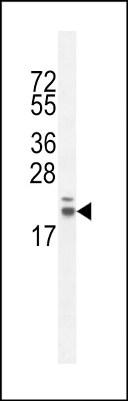 Western blot analysis in CHO cell line lysates (35ug/lane) .